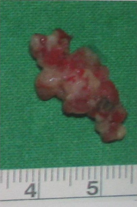 Gross appearance